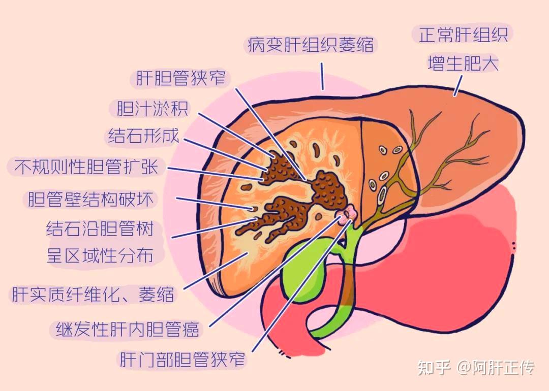 核磁共振成像机器_核磁共振成像技术的作用_核磁共振成像 软件