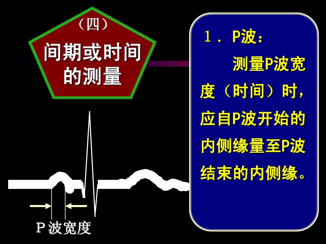 心电图q波改变原因_心电图波形改变_心电图波形的改变的定义及分析